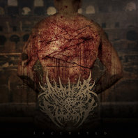 Lacerated Mp3