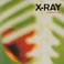 X-Ray (CDS) Mp3