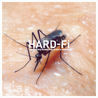 Hard-Fi - Sweating Someone Else's Fever Mp3